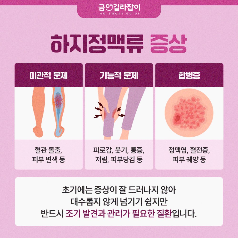 하지정맥류원인(4)