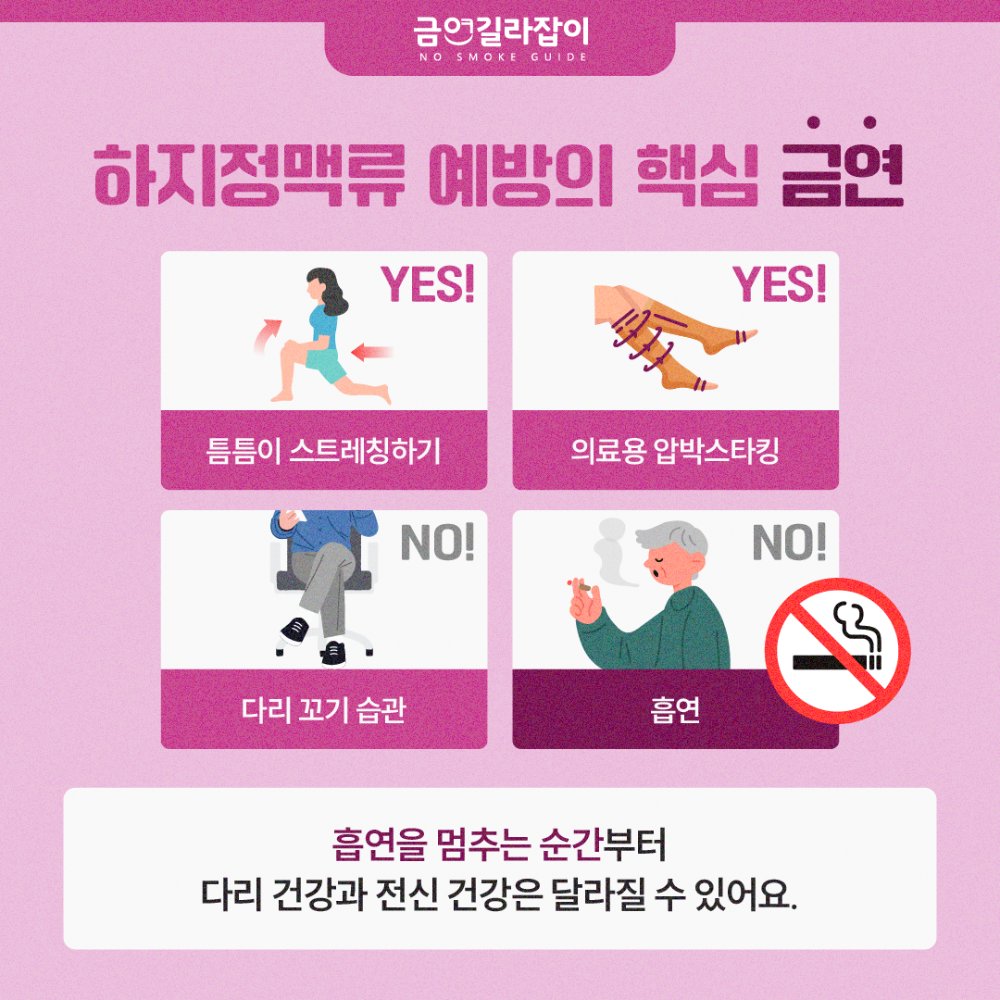 하지정맥류원인(5)